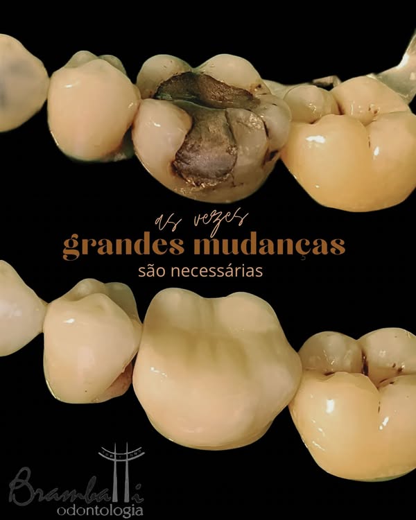 Prótese dental em laboratório e consultório